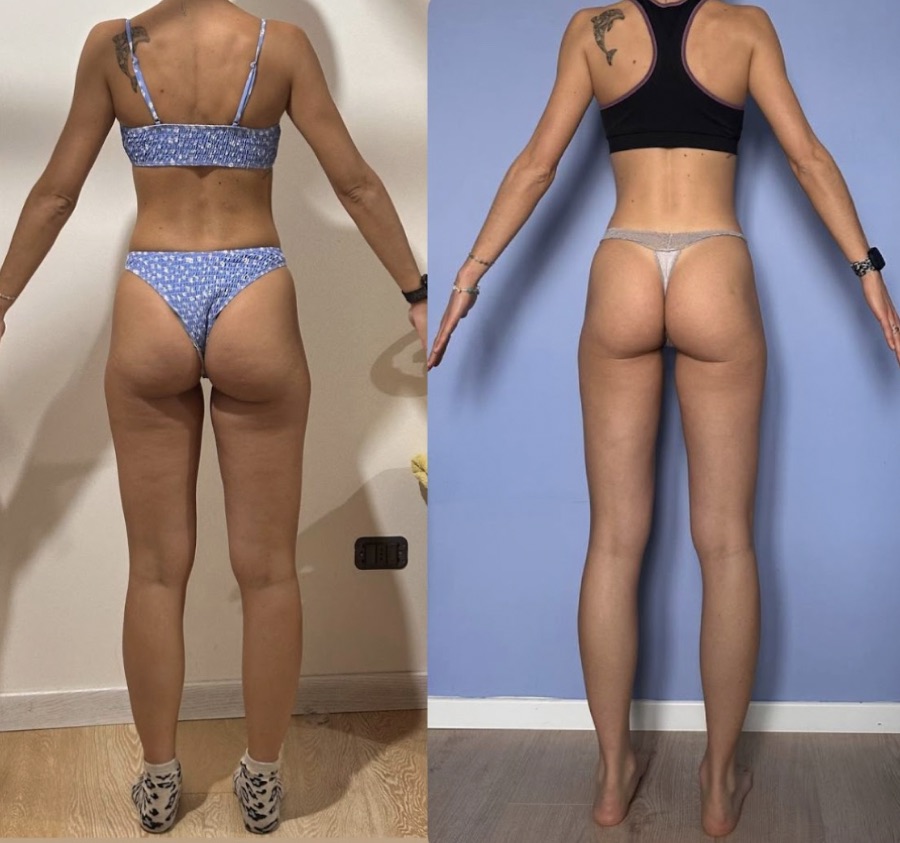 Prima e dopo di una donna di 47 anni